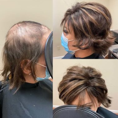 Before and after view of a woman wearing a hair piece sporting a trendy cut