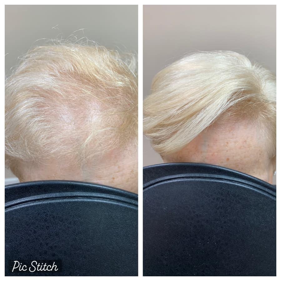 Before and after view of a woman wearing a hair piece